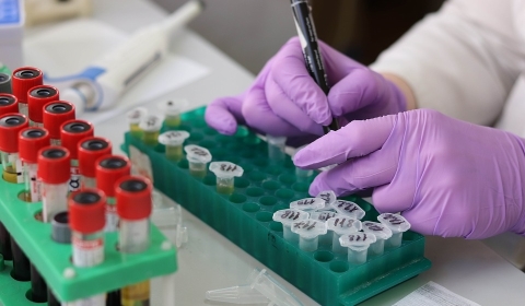 KLSH: Pandemia u keqmenaxhua, laboratoret private u akredituan ne shkelje me ligjin